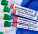 Congo receives first batch of mpox vaccines