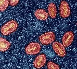Mpox does not easily spread through air: US CDC