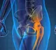 Prostate cancer: A curable ailment that causes social stigma