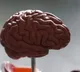 Evidence grows to show air pollution can raise Parkinson’s risk