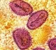 India reports first mpox case of clade 1b from Kerala