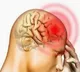 Meningitis: Infants, young kids at higher risk, vaccines may help, say experts