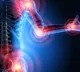 Increased understanding of arthritis helps overcome complications, say doctors
