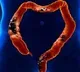 Study shows how stress worsens colorectal cancer