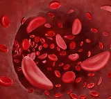 ICMR, Zydus tie up for clinical trial to combat sickle cell disease