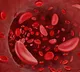 ICMR, Zydus tie up for clinical trial to combat sickle cell disease
