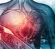 Chip based blood test will find heart attack chances in minutes