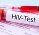AIDS Society of India urges government to include HIV self-testing in policies