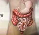 Scientists link colon cancer risk to specific gene in ulcerative colitis