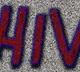 19 Youth infected to HIV from 17 year old girl