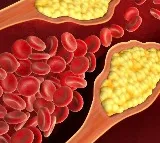 Covid infection spiked high cholesterol risk by 30pc: Study