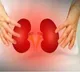 How kidney problems raise risk of strokes