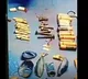 Batteries blades among 56 objects removed from UP boys stomach