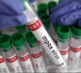 US confirms first case of clade I mpox in California