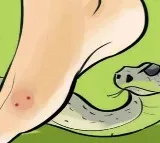 Centre declares snakebites a notifiable disease in India