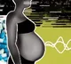 US scientists find common antiseizure drugs safe for pregnancy