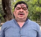 Ponnam Prabhakar says will invite KCR and Bandi Sanjay