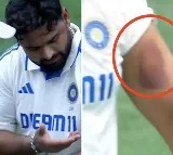 Rishabh Pant Injured by Mitchell Starc's Bowling in Sydney Test; Video Goes Viral