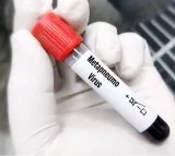 Third HMPV case identified in Gujarat