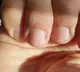 The telltale signs of poor health that your hands reveal