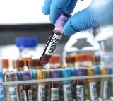 are you know about chloride blood test