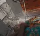 Newborn Childs Heart Beat That Stopped It Suddenly Came Back To Life after CPR
