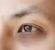 Dark Circles Are Red Flag Symptoms of THIS Potentially Dangerous Condition That Causes Breathlessness