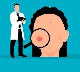 complexion getting dark this health issue may be the reason