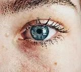 warning signs of heart attack that appear in your eyes before a month