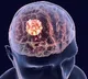 Israeli researchers develop AI tool to decode cell responses to drugs