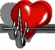 Heart failure may dent attention span and problem-solving skills early: Study