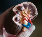 Best Foods to Prevent Kidney Stones, What to Avoid