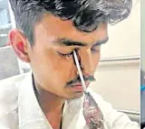 Screwdriver Removed From Young Mans Eye at Gandhi Hospital