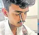 Screwdriver Removed From Young Mans Eye at Gandhi Hospital