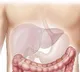 World Liver Day: Fix food habits to cut liver disease risk by 50 pc