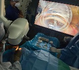 Army Hospital performs its first minimally invasive glaucoma surgery
