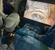 Army Hospital performs its first minimally invasive glaucoma surgery