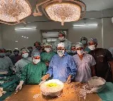 Telangana’s first intestine transplant performed at Osmania Hospital