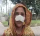 West Bengal Man Bites Off Wife’s Nose for Being 'Too Attractive'