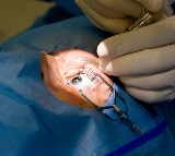 Spinal Tumor Removed Through Eye Socket A Medical Miracle