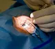 Spinal Tumor Removed Through Eye Socket A Medical Miracle