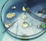 Is Aspergillus the Next Pandemic