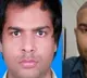 Kanpur Hair Transplant Clinic Another Engineer Dies After Treatment