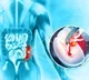 Bowel Cancer Silent Killer in Youth