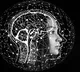 Govt to aid development of India's 1st indigenous thrombectomy device for stroke care