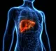 Liver Cancer Early Detection Symptoms and Signs