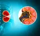 Facts about Kidney stones