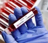 New Virus Like COVID 19 Identified in China Scientists Warn