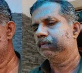 Balakrishnan Assaults Old Friend After 50 Years Over School Fight