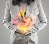 Simple Tips for Relief from Gas Trouble